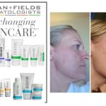 Rodan & Fields – Life Changing Skin Care That I Love