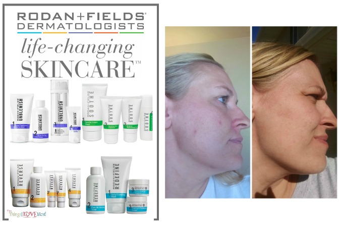 Rodan & Fields – Life Changing Skin Care That I Love